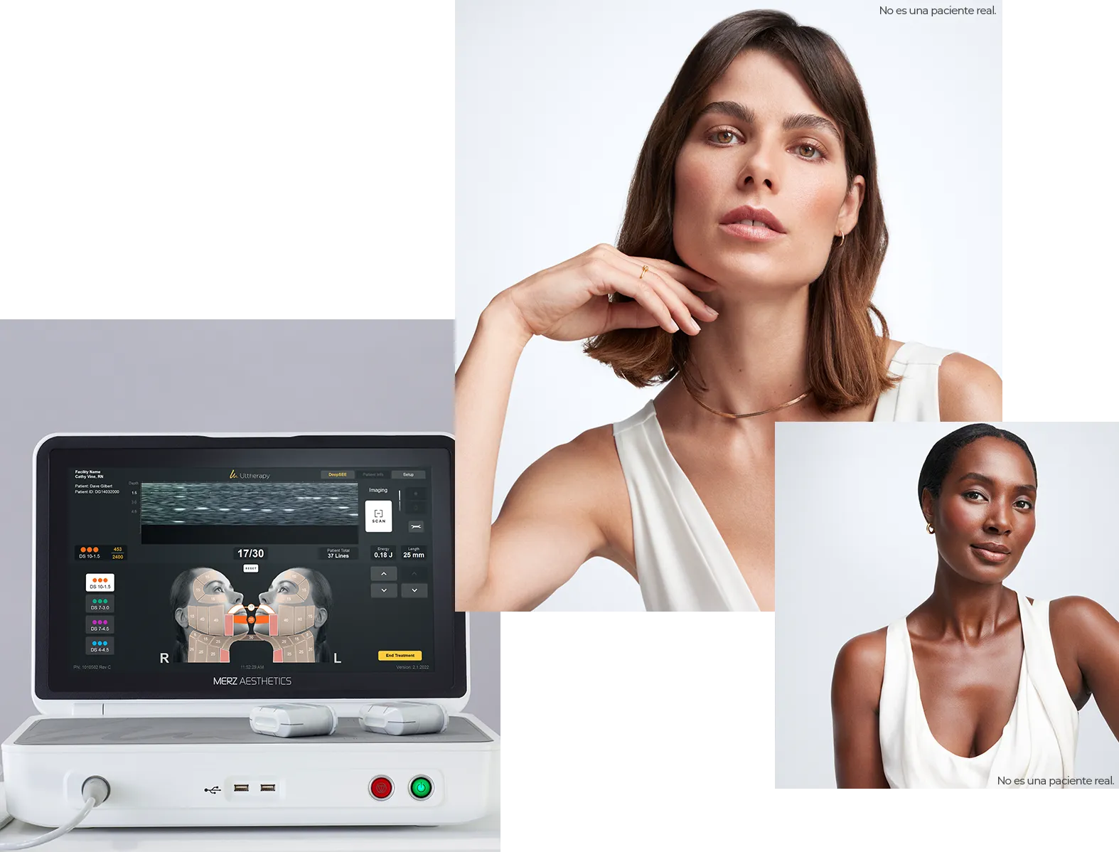 Collage featuring the Ultherapy PRIME&reg; device control unit and two women (not actual patients).