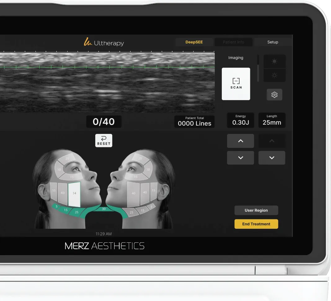 Equipo completo de Ultherapy PRIME® para el lifting y la tensión de piel no invasivos.