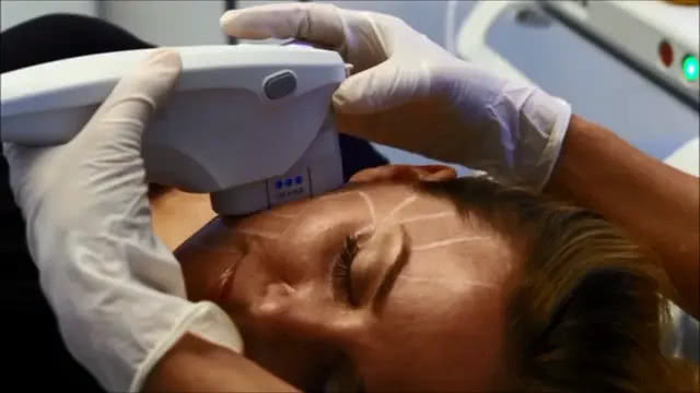 Ultherapy in the news: Alive & Well